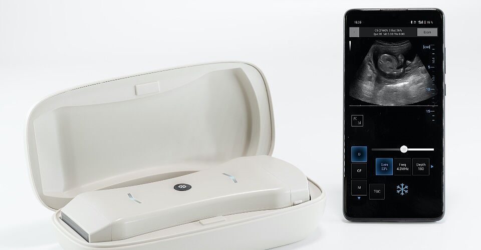 УЗД сканер SpectrUs