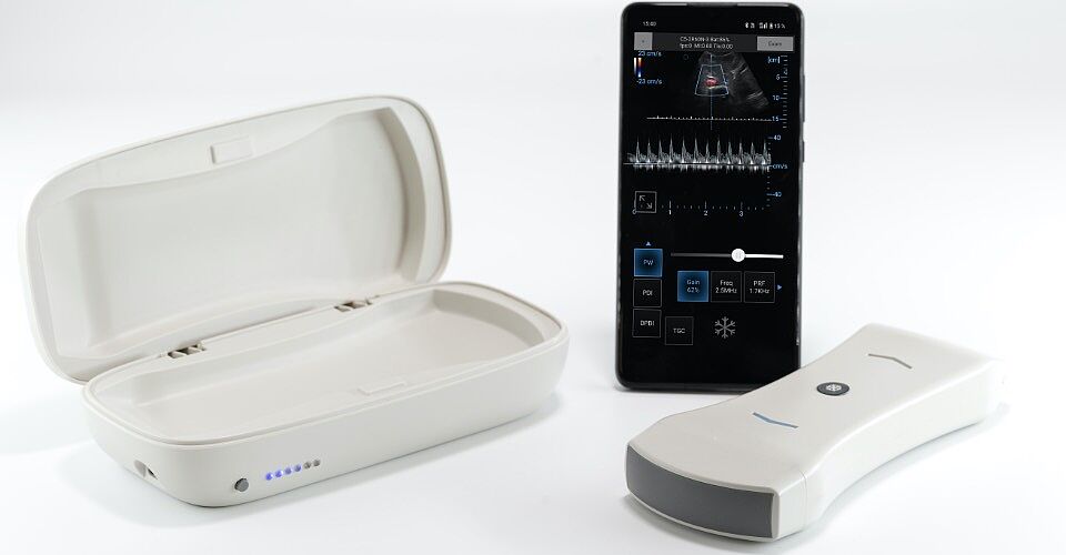 УЗД сканер SpectrUs