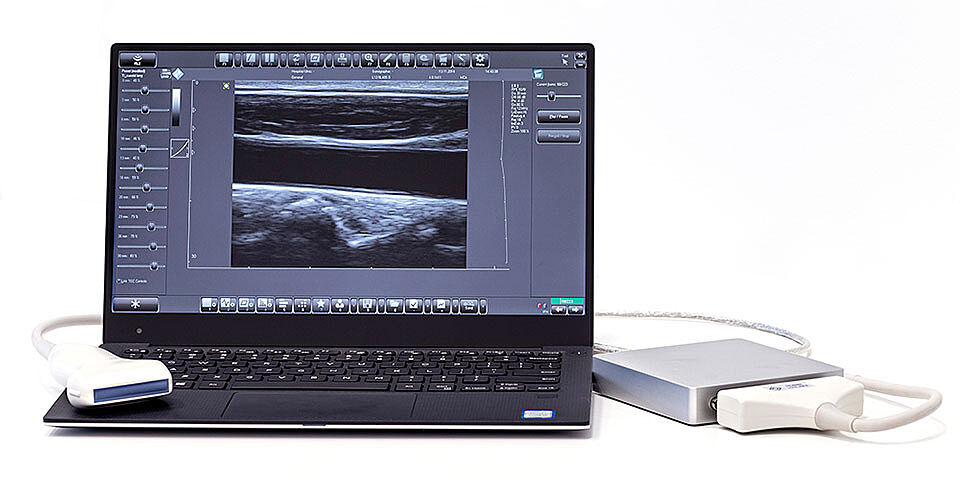 УЗИ сканеры